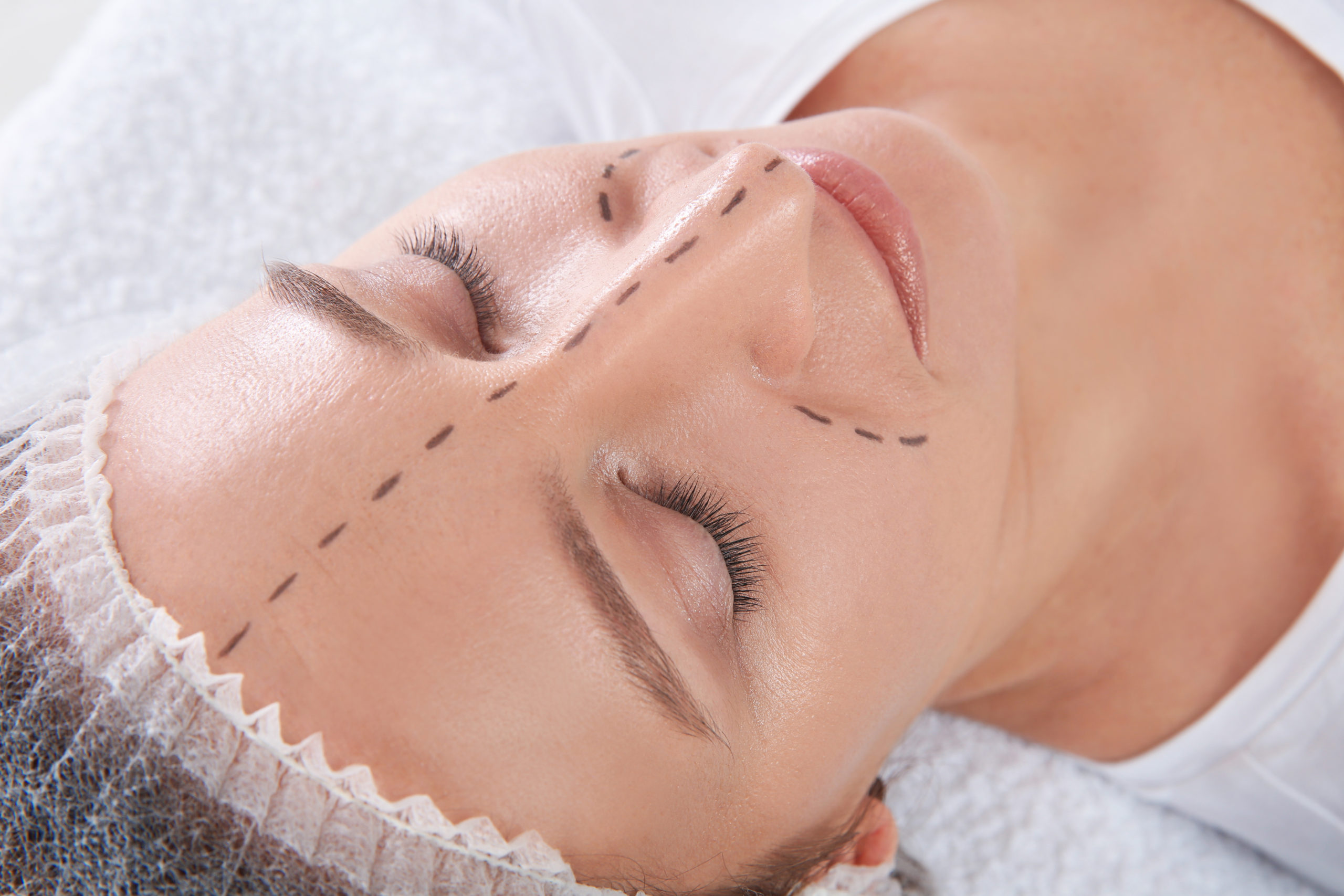 Mature woman with marks on face before cosmetic surgery in clinic Dr Ciardullo Cosmetic Makeovers